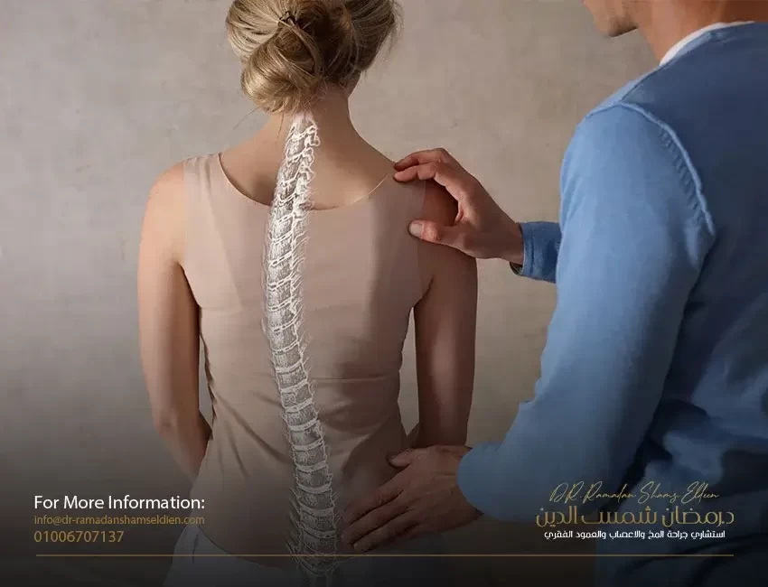 ما هو مرض الجنف؟ وأنواعه وأشهر الأعراض